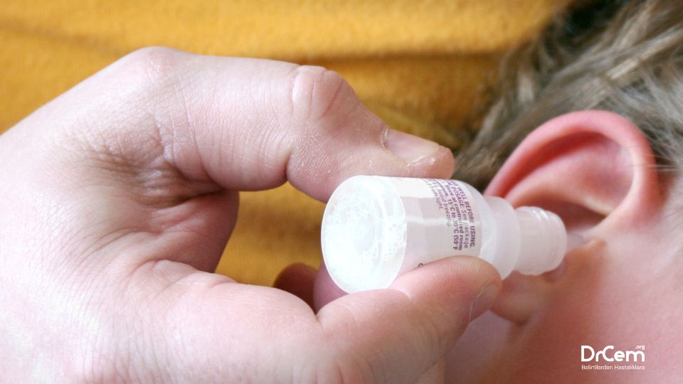 Otitis Eksterna görseli - DrCem hastalık rehberi